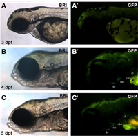 The  transgenic zebrafish marks only bone structures derived from osteoblasts.